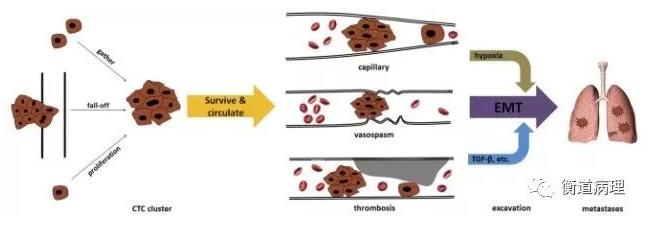 CTC的分類 CTC的分類