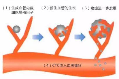 CTC檢查是測(cè)定血液中流動(dòng)癌細(xì)胞的一種檢查